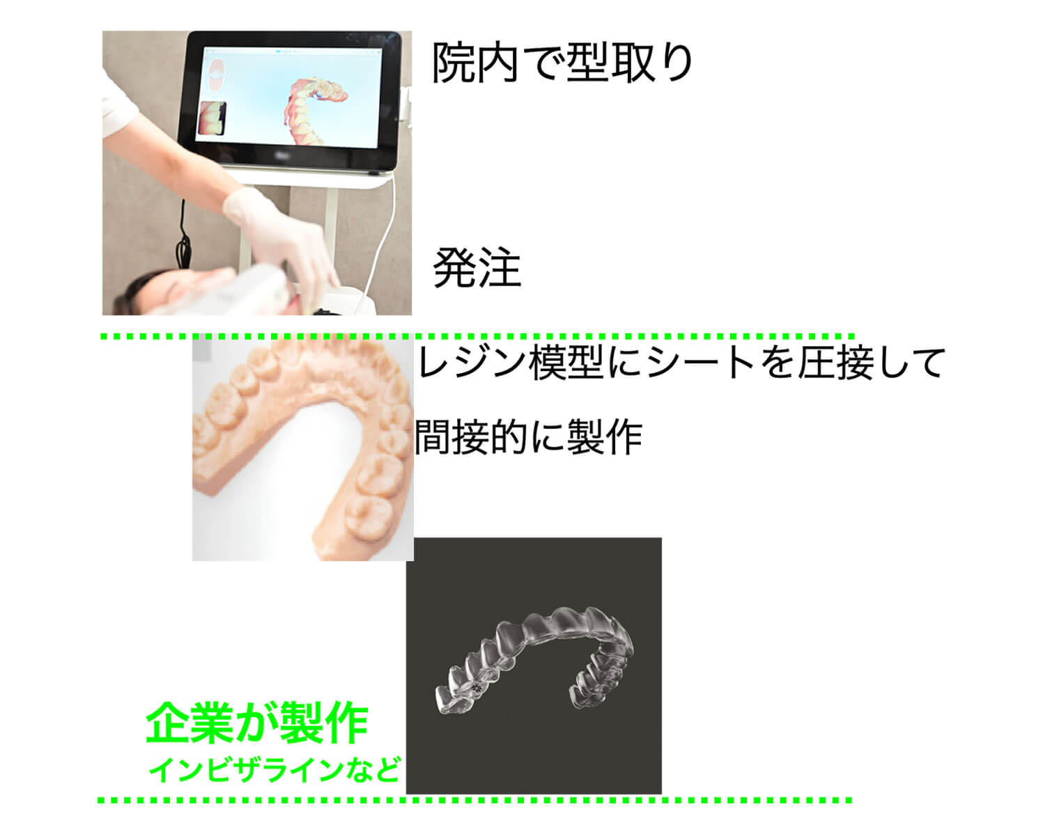 企業が製造するアライナー