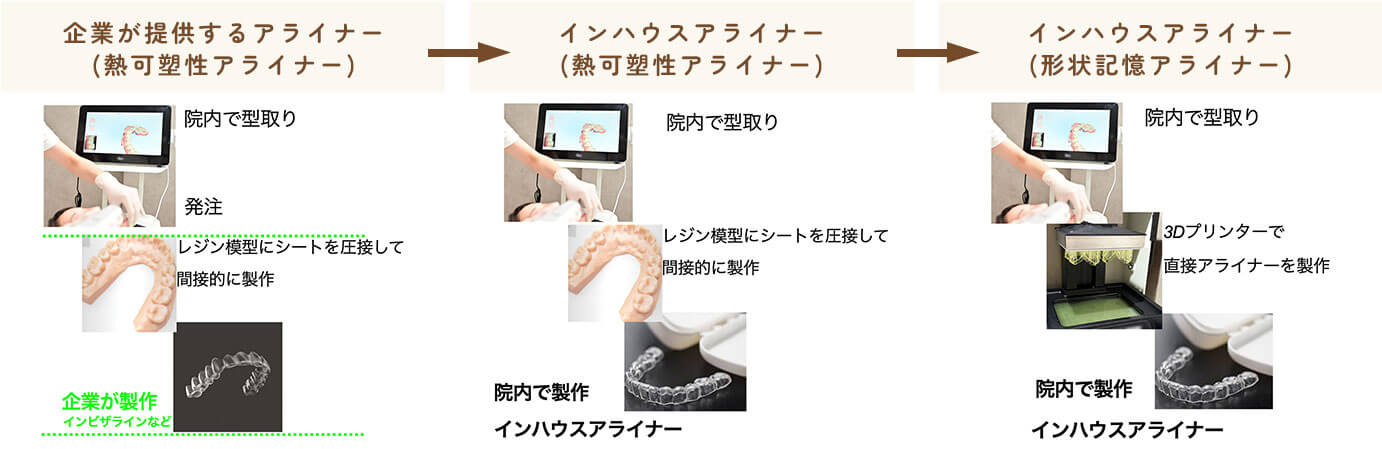 アライナー矯正装置の変遷