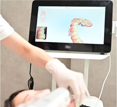 口腔内スキャナー